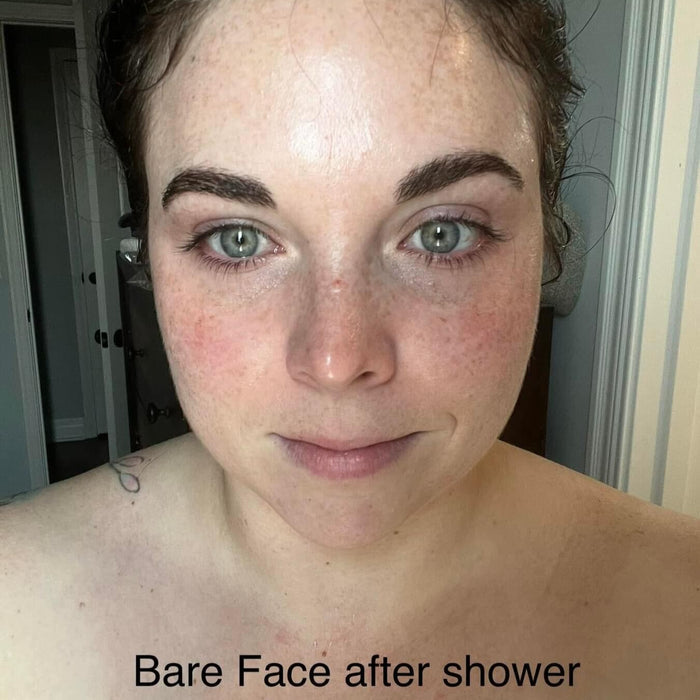 A customer showing what her under eye area looks like before applying Frownies under eye gels