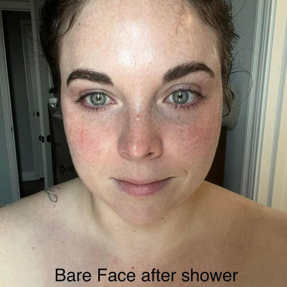 A customer showing what her under eye area looks like before applying Frownies under eye gels