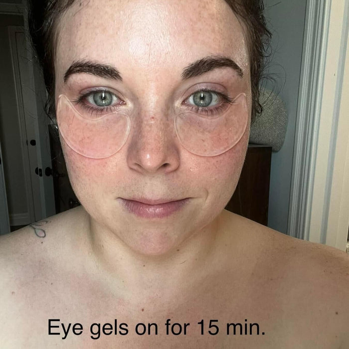 A customer showing her wearing Frownies under eye gels