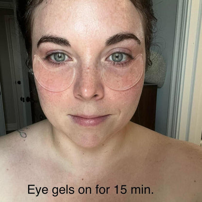 A customer showing her wearing Frownies under eye gels