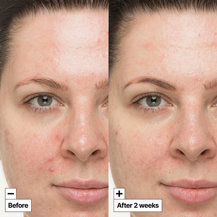 CICAPAIR SO SOOTHING TREATMENT - Tratament Intensiv Cu Efect Calmant - skinseen.ro