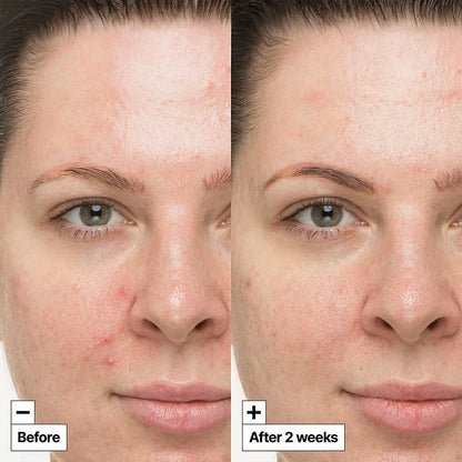 CICAPAIR SO SOOTHING TREATMENT - Tratament Intensiv Cu Efect Calmant - skinseen.ro