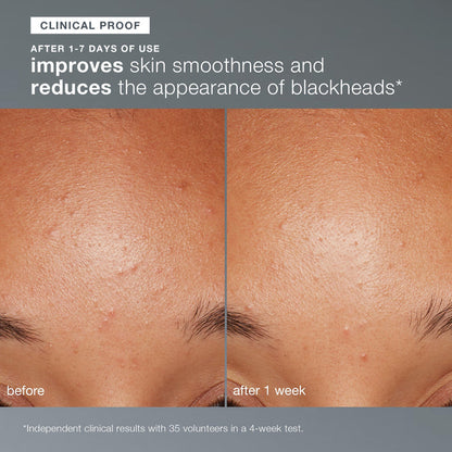 cleansing travel trio (precleanse, special cleansing gel and daily microfoliant)