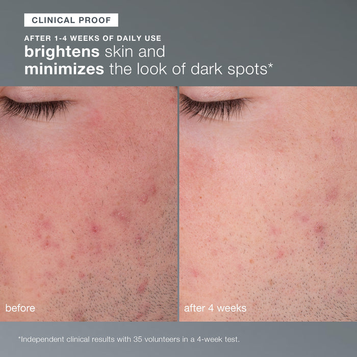 cleansing travel trio (precleanse, special cleansing gel and daily microfoliant)