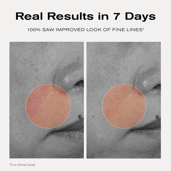 Tightening Treatment Mask
