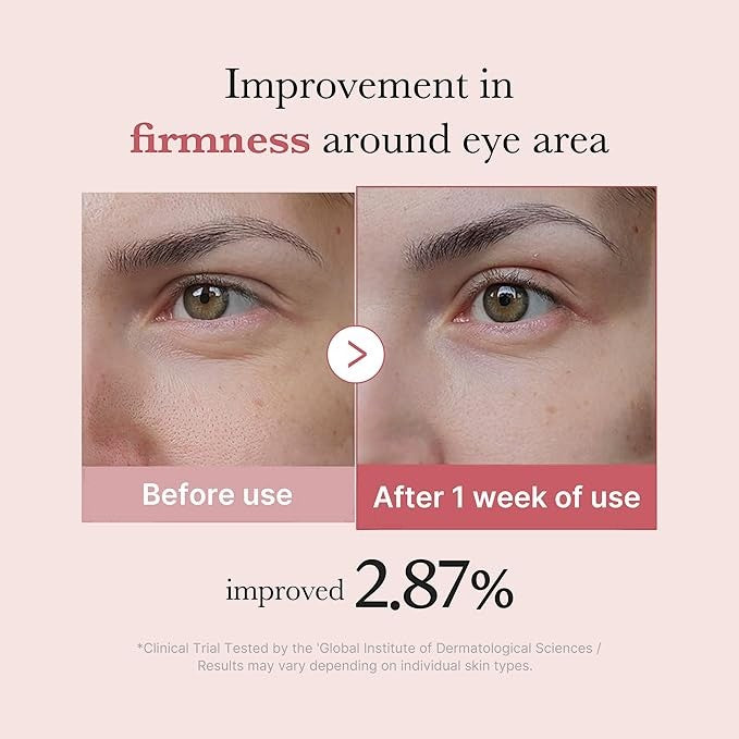 medicube PDRN Pink Peptide Eye Serum 30ml | VGLE Beauty Canada