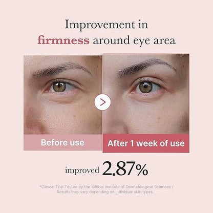medicube PDRN Pink Peptide Eye Serum 30ml | VGLE Beauty Canada