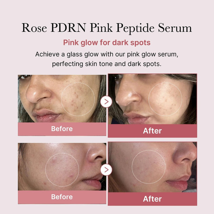 medicube PDRN Pink Peptide Serum, Pink glow serum, Peptide, Niacinamide, Hydrating & Moisturizing & Firming, Uneven Skin Tone, Korean Skincare