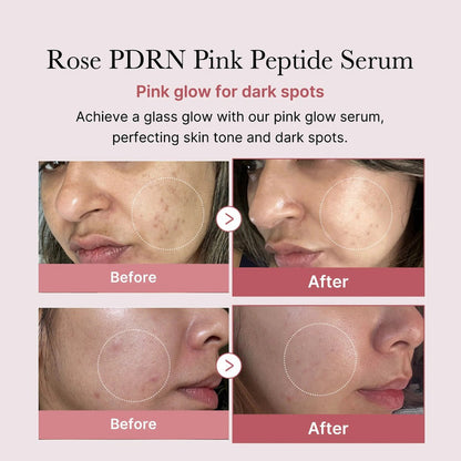 medicube PDRN Pink Peptide Serum, Pink glow serum, Peptide, Niacinamide, Hydrating & Moisturizing & Firming, Uneven Skin Tone, Korean Skincare