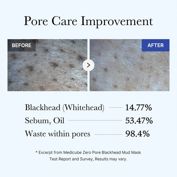 medicube Zero Pore Blackhead Mud Mask VGLE Studios