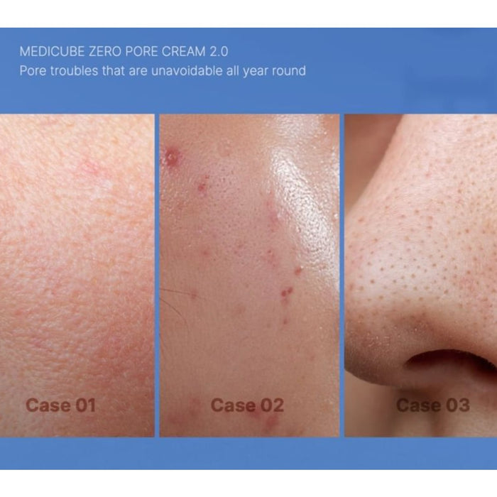 medicube Zero Pore Cream 2.0 50ml medicube