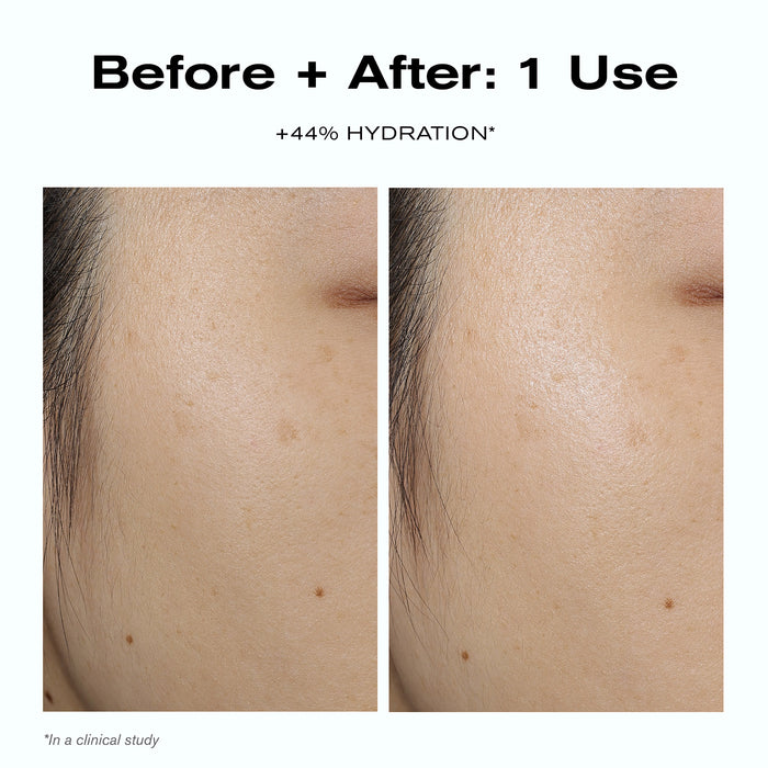 Before + After 1 Use +44% Hydration* 
*In a clinical study.
