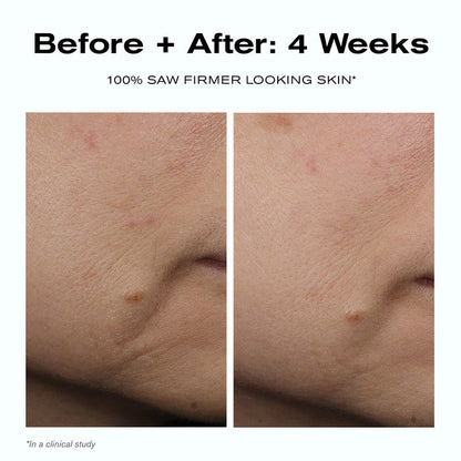 Before + After: 4 Weeks
100% saw firmer looking skin*
*In a clinical study