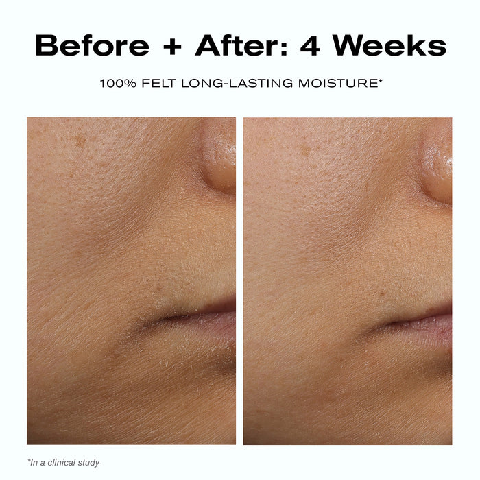 Before + After: 4 Weeks
100% felt long-lasting moisture*
*In a clinical study.