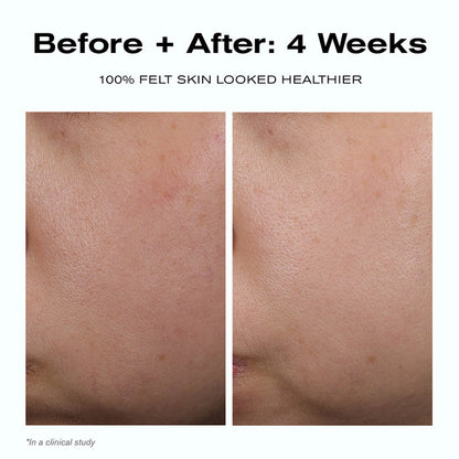 Before + After: 4 Weeks
100% felt skin looked healthier*
*In a clinical study