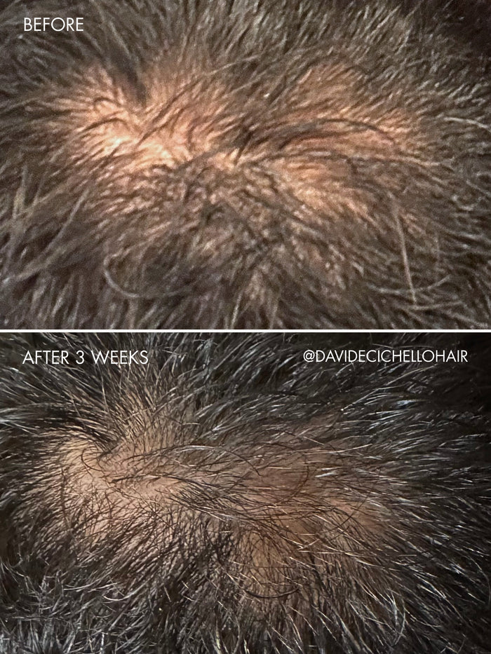 The Hair Serum
