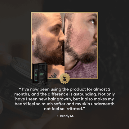 Voxtr Patchy Beard Kit, image 2. The Beard Struggle